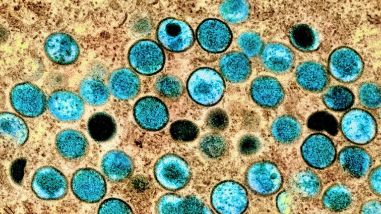 Vírus Mpox Avança no Brasil: 149 Casos Confirmados em 13 Estados